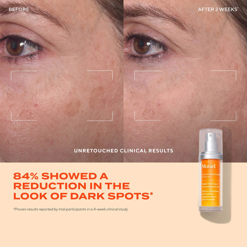 MURAD Rapid Dark Spot Correcting Serum