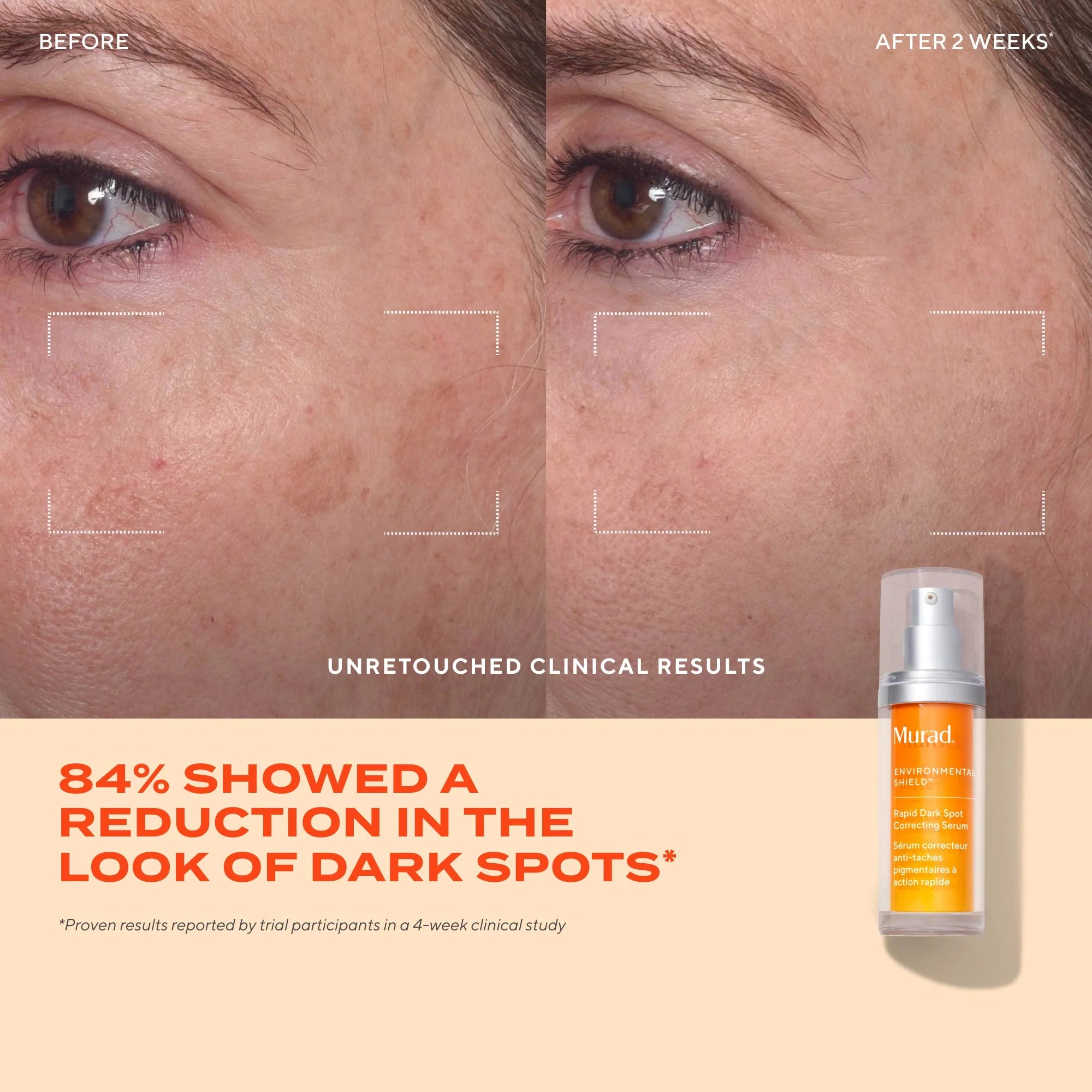 MURAD Rapid Dark Spot Correcting Serum